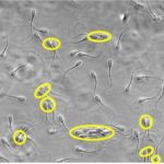 Trial assesses nitrogen and phosphorus use