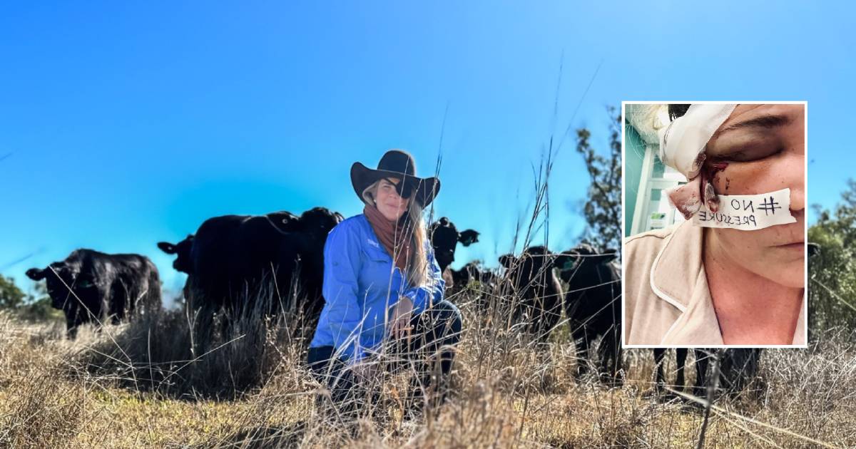 Gracemere’s Zoe Corrie faces physical and emotional recovery after horse kick to the head | Queensland Country Life